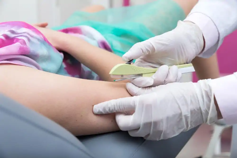 Implantes hormonais